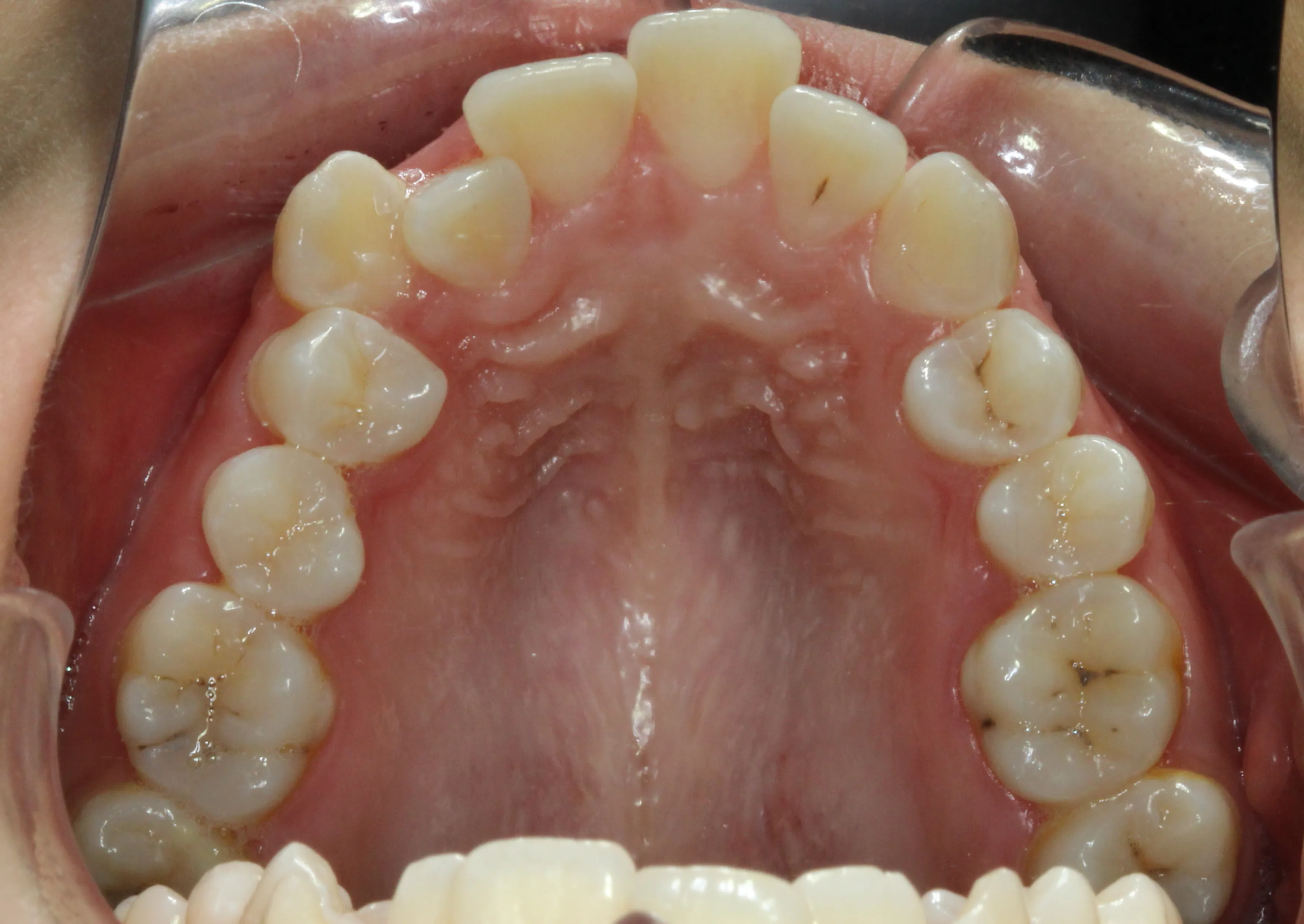 ortodoncia Adolescentes